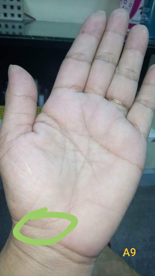 A9 LIFE LINE CROSS AT THE END