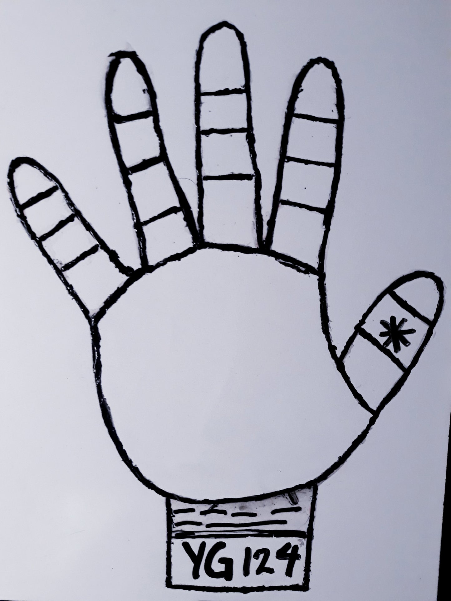 YG124 ASTERIC AT SECOND PHALANGE THUMB
