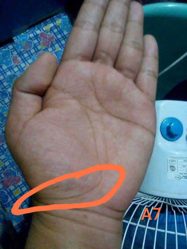 A7 LIFE LINE CURVE TO THUMB