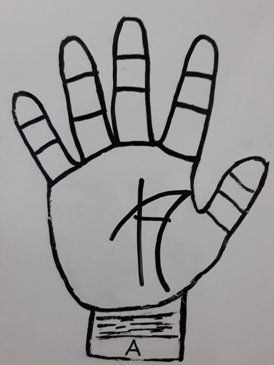 A17 SERIOUS ATTACHMENT AT YOUNG AGE