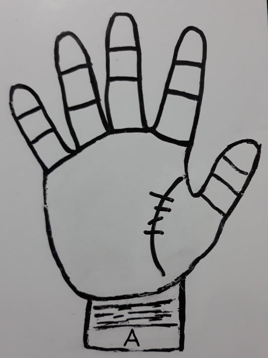 A27 INTERSECTING LINE ON THE LIFE LINE