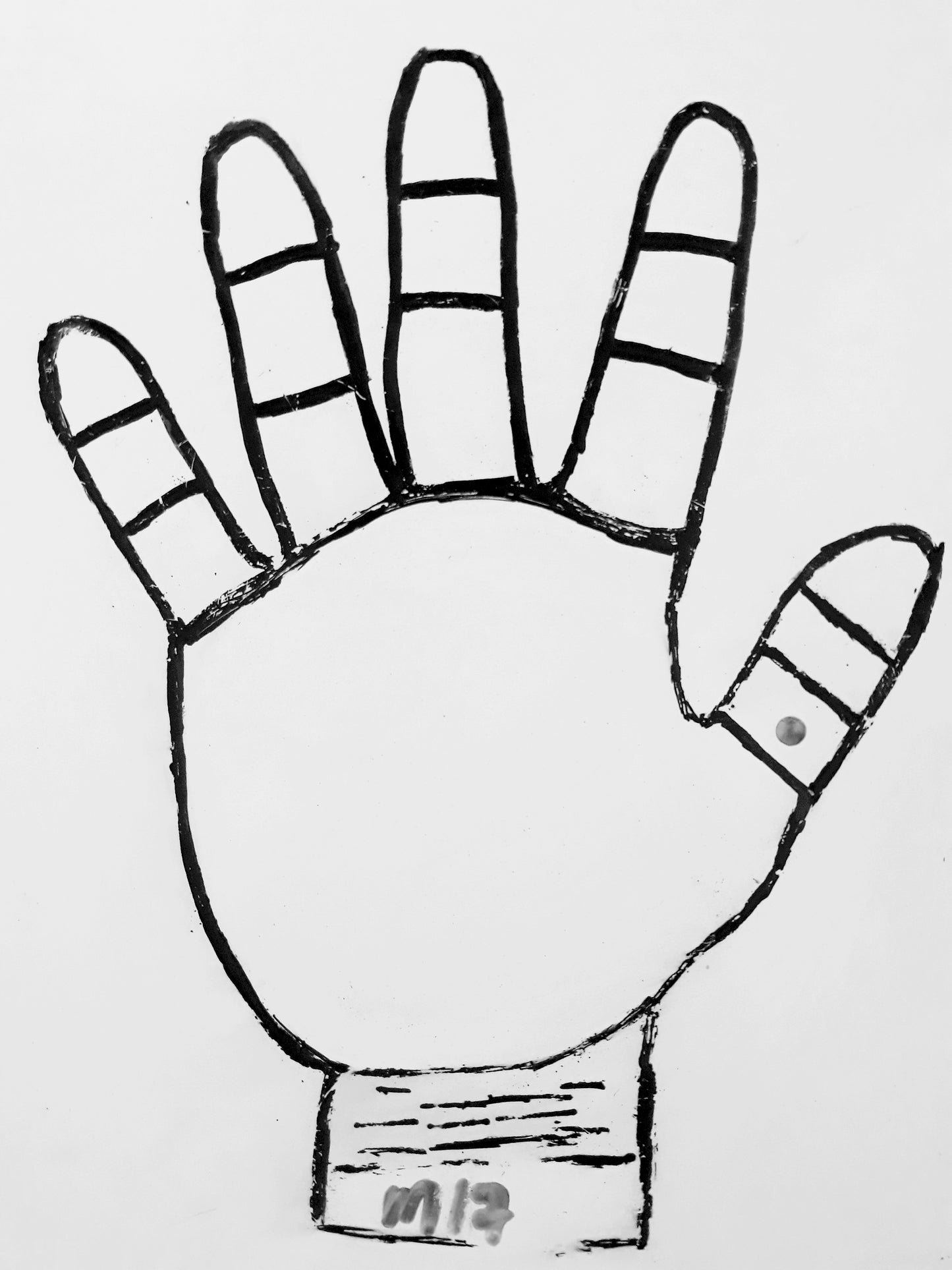M17  MOLE ON THE THUMB FINGER