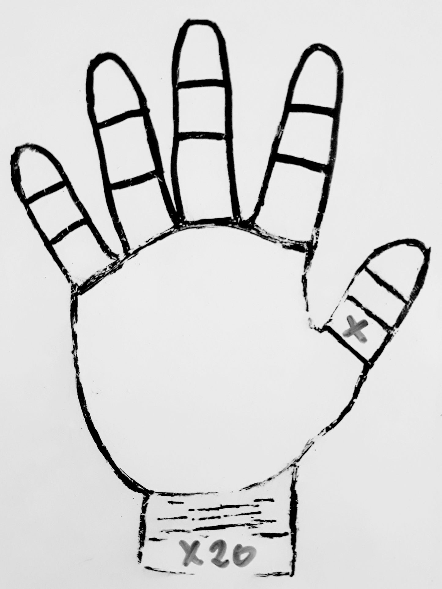 X20 CROSS ON THUMB PHALANGE